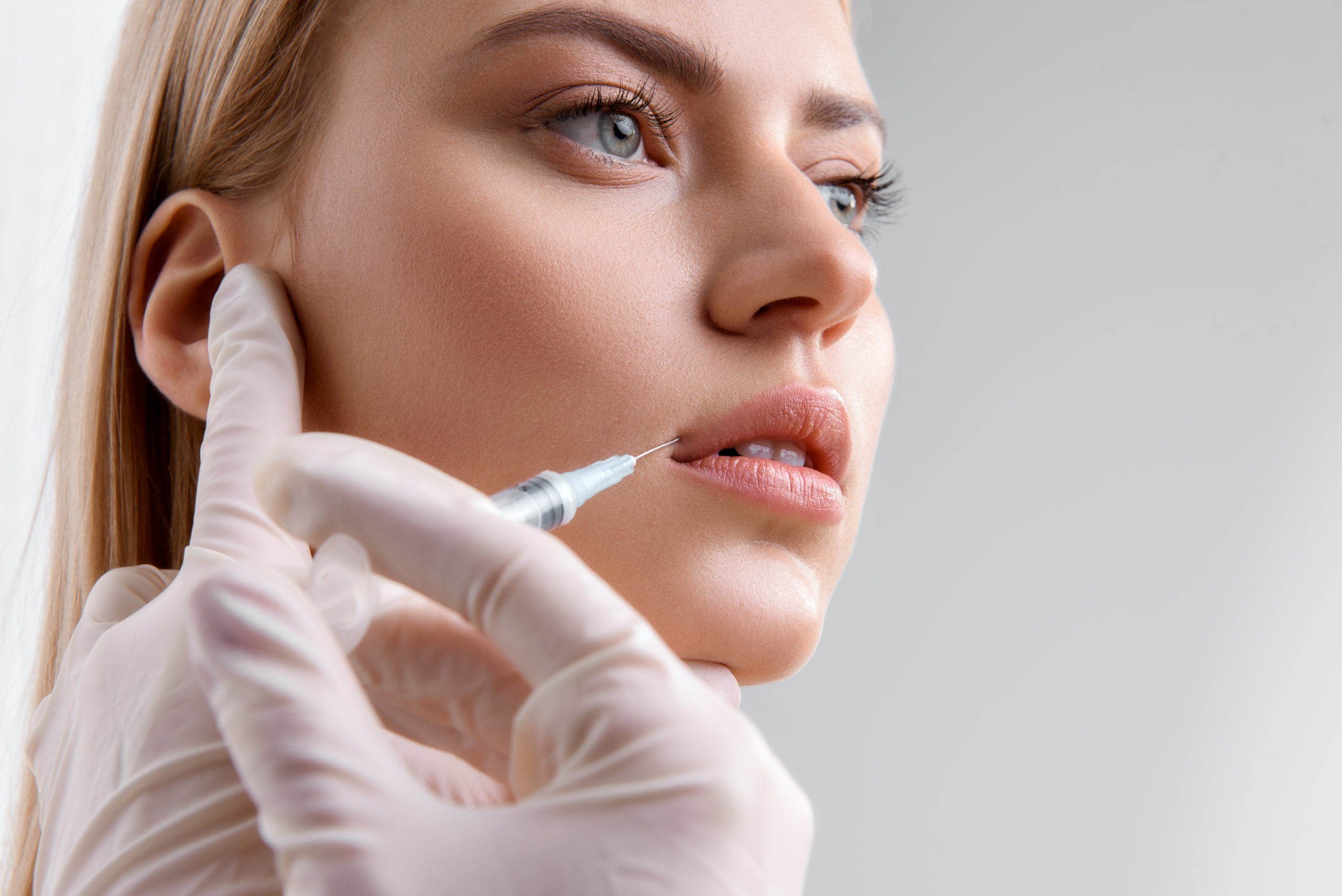 Dermal Fillers